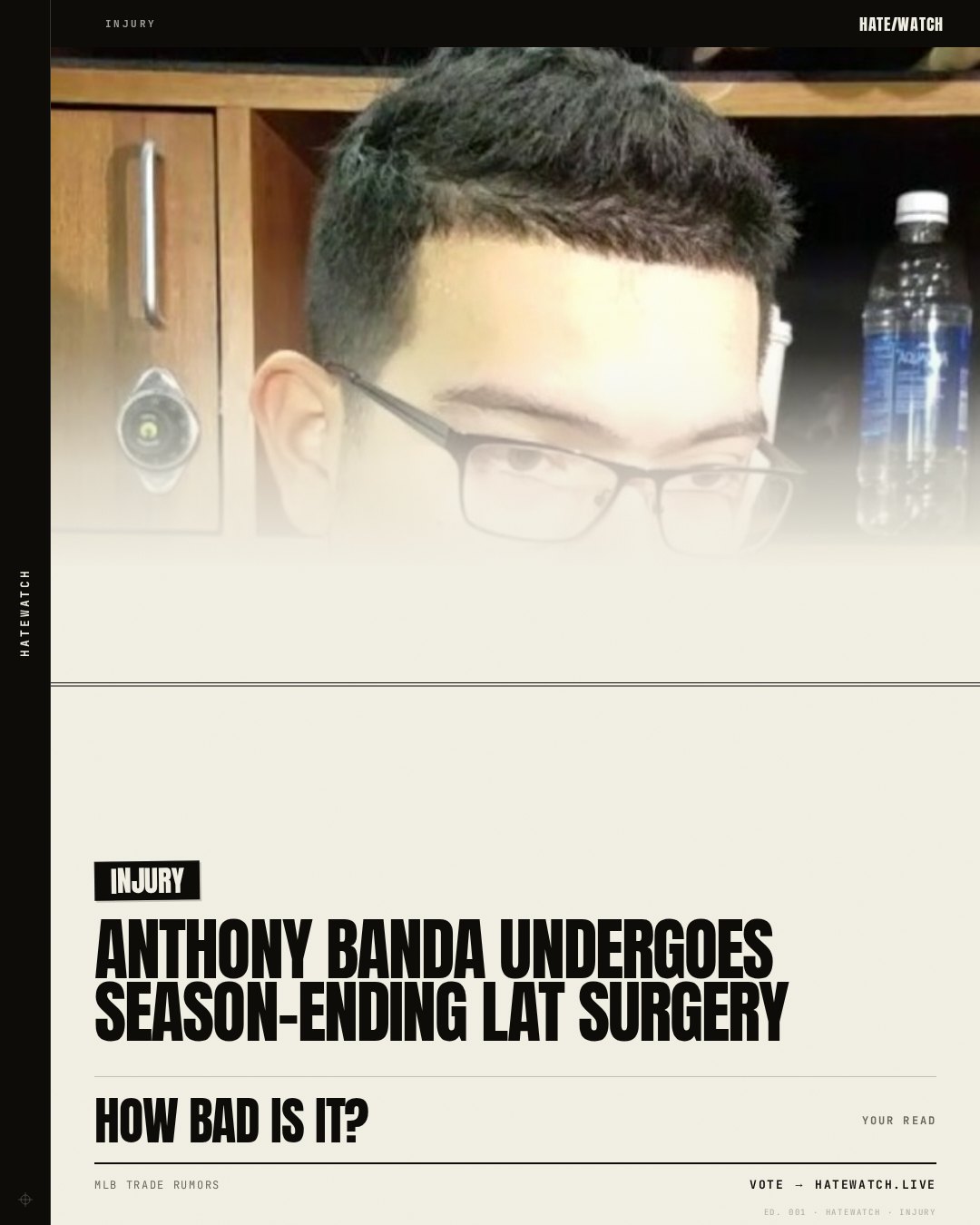 Anthony Banda Undergoes Season-Ending Lat Surgery